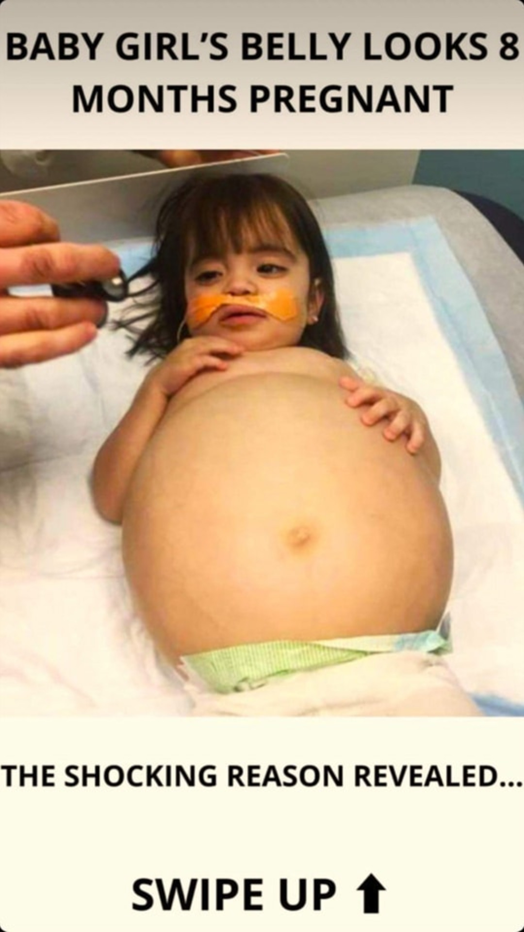 S3. Young girl saved by dad’s kidney donation after deadly disease made her look 8 months pregnant